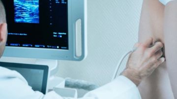 ULTRASSONOGRAFIA DOPPLER VENOSO DOS MEMBROS INFERIORES 